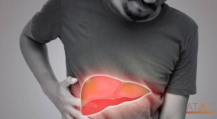 Wie Sie Ihre Leber bei der Einnahme oraler Steroide schützen können